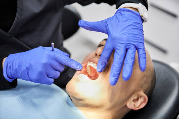Best Emergency Dentist for Knocked-Out Tooth in Marshallton, PA