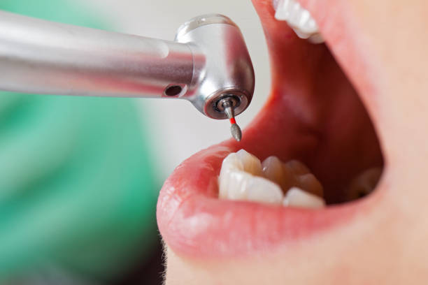 Best Emergency Dentist for Knocked-Out Tooth in Marshallton, PA